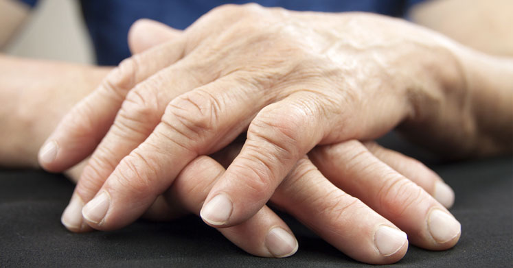 Romatoid Artrit: Romatizmal Ağrılarda Doğal ve Bitkisel Tedaviler