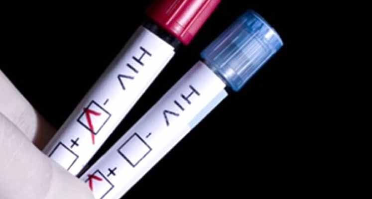 hiv-testi