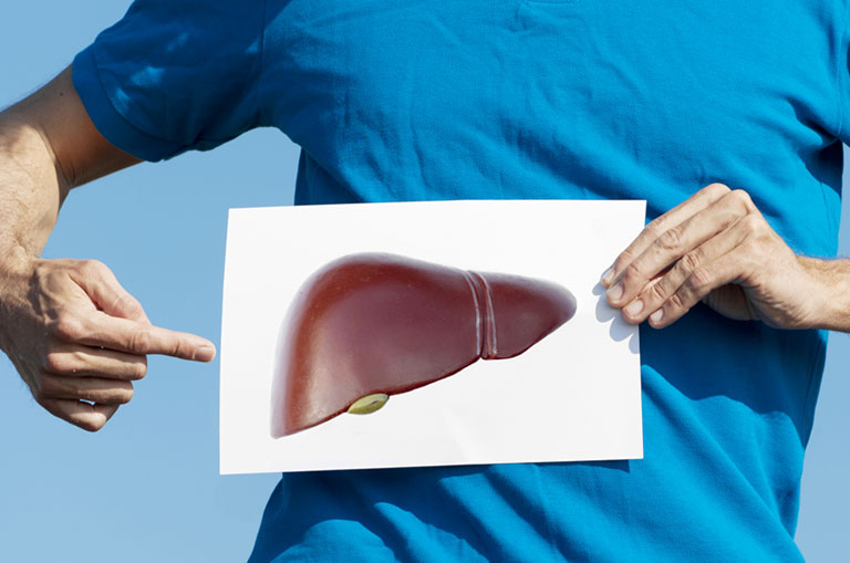 Karaciğer Yağlanması (Hepatik Steatoz) Nedir? Belirtileri ve Tedavisi
