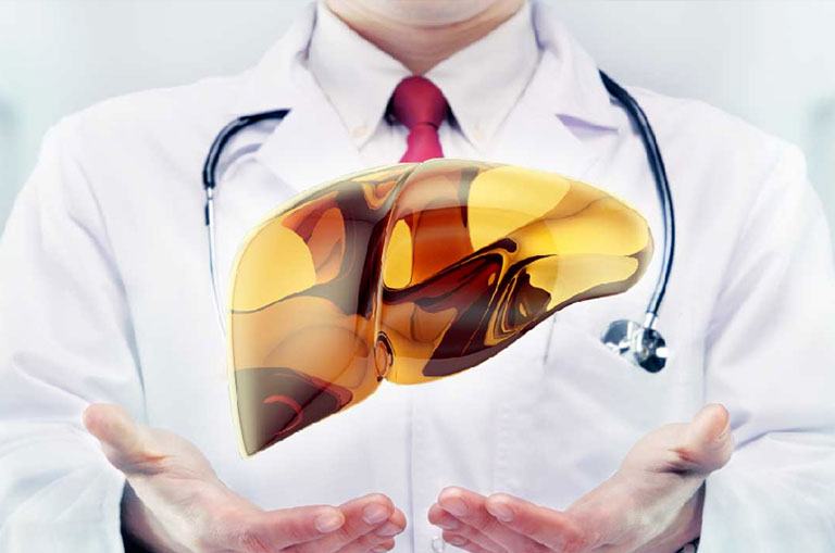 Karaciğer Yağlanması Neden Olur? Belirtileri ve Tedavisi Nedir?