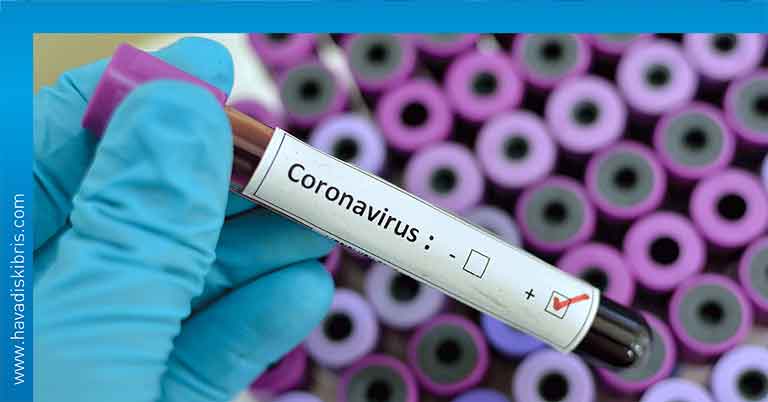 koronavirüs test