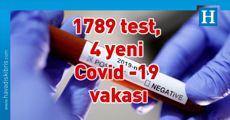 koronavirüs, korona virüs, coronavirus, corona virüs, COVID-19, test, vaka, pozitif, karantina, pandemi, vaka sayısı, test sayısı, PCR, yeni tip koronavirüs, salgın, negatif, Güney Kıbrıs, Kıbrım Rum Sağlık Bakanlığı