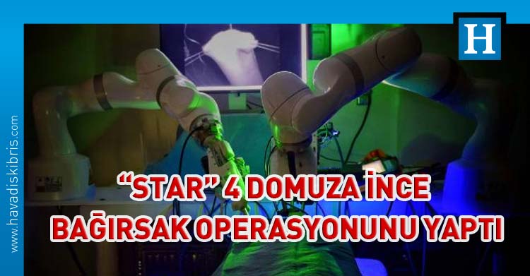 Star robot ameliyat