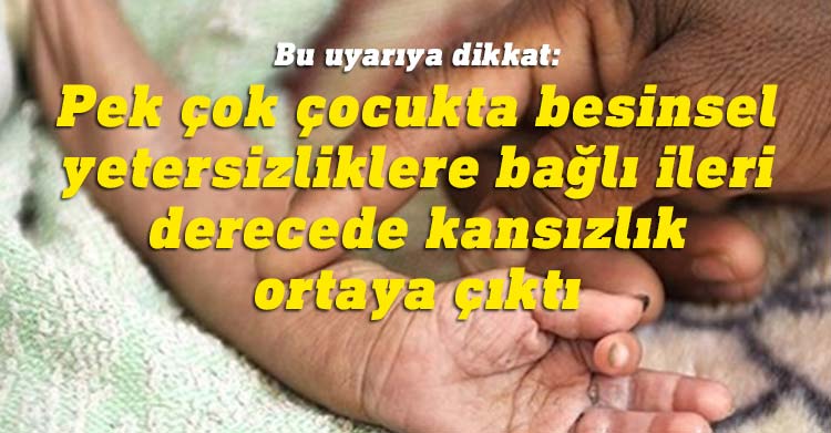 Kıbrıs Türk Pediatri Kurumu uyardı: “Son günlerde pek çok çocuk uygun şekilde beslenemiyor”