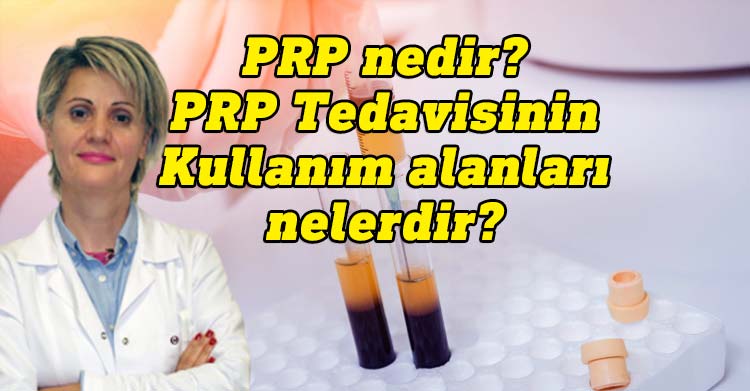 Uzm. Dr. Pervin Fevzioğlu PRP ve PRP tedavisinin kulanım alanlarını yazdı.