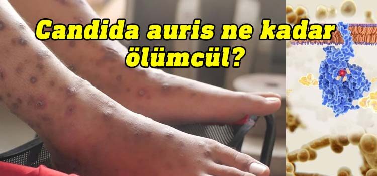 "Candida auris nedir?" "Candida auris Türkiye'de görüldü mü?", "Candida auris ne kadar ölümcül?" ve "Candida auris'in belirtileri nelerdir?"