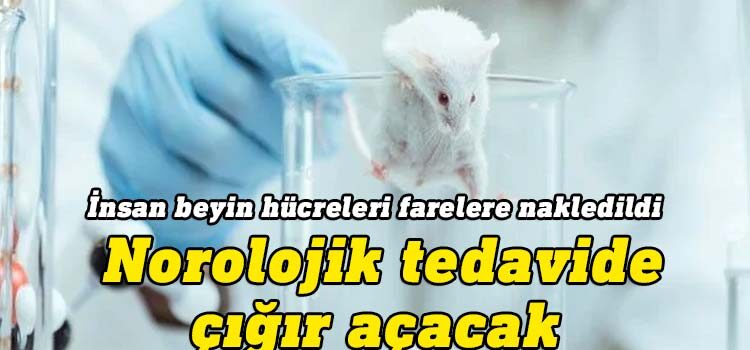 İnsan beyin hücreleri farelere nakledildi