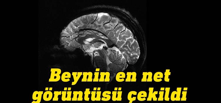 Fransa Atom Enerjisi ve Alternatif Enerjiler Kurumu (CEA), dünyanın en güçlü manyetik rezonans görüntüleme (MRI) cihazıyla elde edilen, insan beyninin en net görüntüsünü yayınladı.