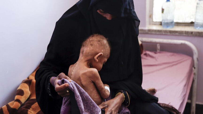 BM’den Yemen’de 18 milyondan fazla insanın şiddetli açlık çektiği uyarısı